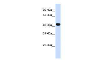 HS3ST3B1 Rabbit Polyclonal Antibody