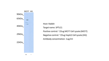 SPTLC1 Rabbit Polyclonal Antibody