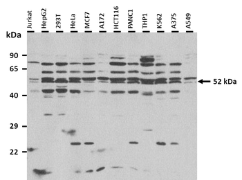 BTNL3 Rabbit Polyclonal Antibody