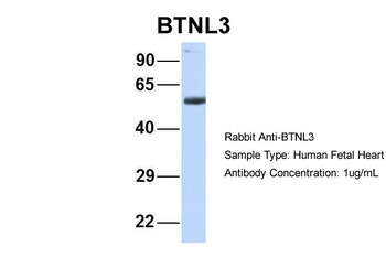 BTNL3 Rabbit Polyclonal Antibody