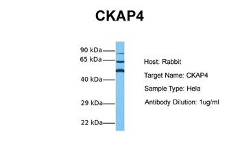 CKAP4 Rabbit Polyclonal Antibody