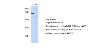 CKAP4 Rabbit Polyclonal Antibody