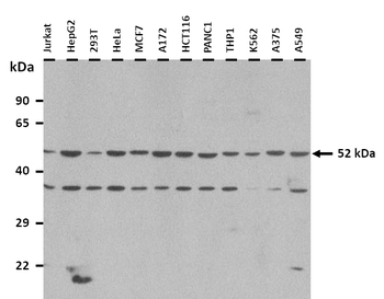 FICD Rabbit Polyclonal Antibody