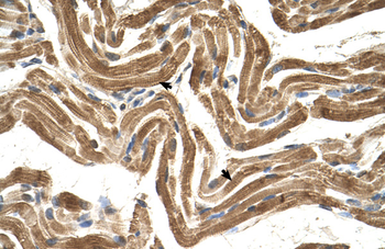 FICD Rabbit Polyclonal Antibody
