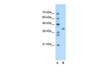 TMEM59L Rabbit Polyclonal Antibody