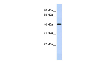HAVCR1 Rabbit Polyclonal Antibody