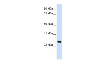 C20orf103 Rabbit Polyclonal Antibody