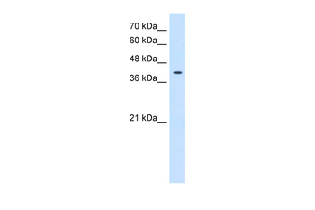 TSPAN12 Rabbit Polyclonal Antibody