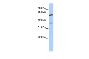 TNFRSF21 Rabbit Polyclonal Antibody