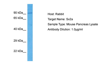 SV2A Rabbit Polyclonal Antibody