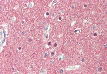 SV2A Rabbit Polyclonal Antibody