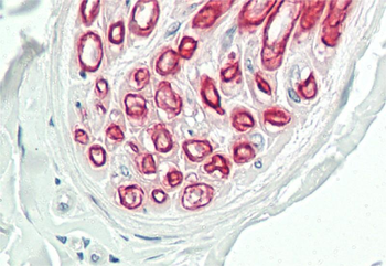 NOX3 Rabbit Polyclonal Antibody