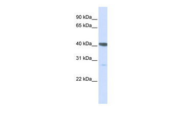 DNAJB11 Rabbit Polyclonal Antibody
