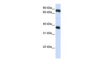 GP6 Rabbit Polyclonal Antibody