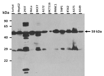 ADA2 Rabbit Polyclonal Antibody