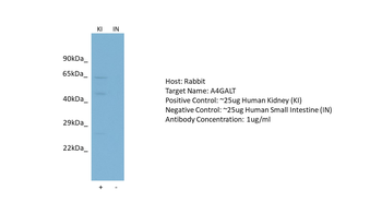 A4GALT Rabbit Polyclonal Antibody
