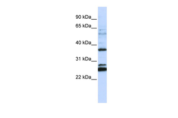 FAM70A Rabbit Polyclonal Antibody