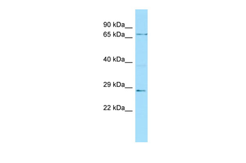 FBXW7 Rabbit Polyclonal Antibody