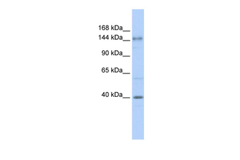 SAC Rabbit Polyclonal Antibody