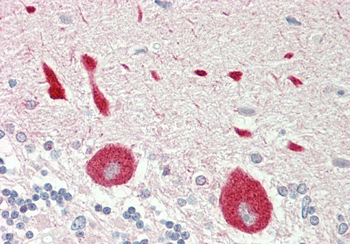 STYK1 Rabbit Polyclonal Antibody