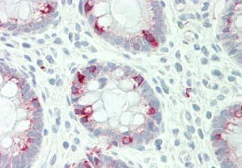 STYK1 Rabbit Polyclonal Antibody