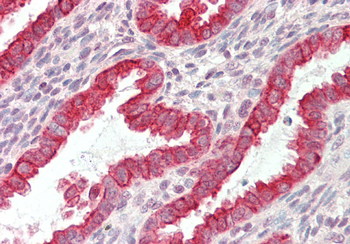 KRT19 Rabbit Polyclonal Antibody