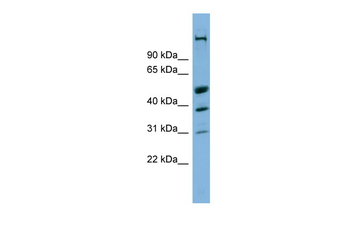 CREBZF Rabbit Polyclonal Antibody