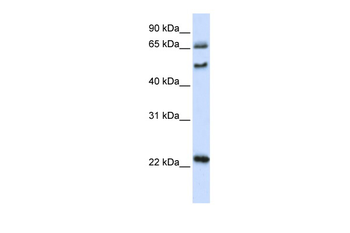 UNCX Rabbit Polyclonal Antibody