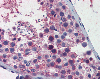 SMC3 Rabbit Polyclonal Antibody