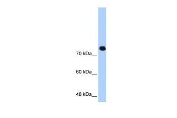 SMC3 Rabbit Polyclonal Antibody