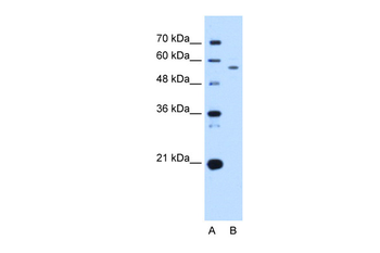 UBXD2 Rabbit Polyclonal Antibody