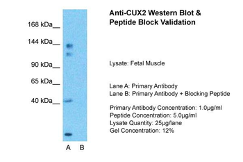 CUX2 Rabbit Polyclonal Antibody