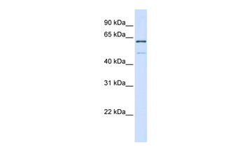 METT10D Rabbit Polyclonal Antibody