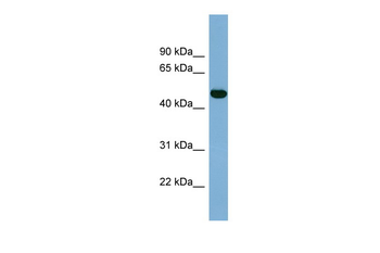 IRX1 Rabbit Polyclonal Antibody