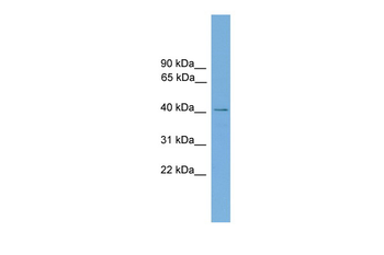 ZNF367 Rabbit Polyclonal Antibody
