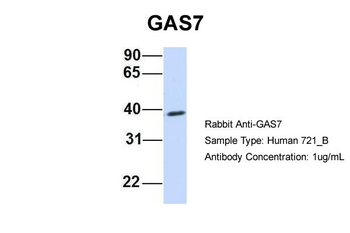 GAS7 Rabbit Polyclonal Antibody
