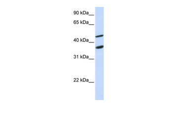 GAS7 Rabbit Polyclonal Antibody