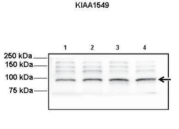 KIAA1549 Rabbit Polyclonal Antibody