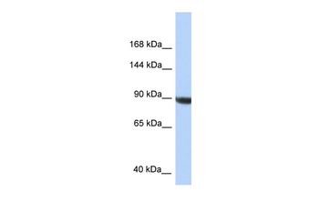 KIAA1549 Rabbit Polyclonal Antibody