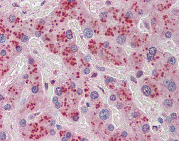 NDRG2 Rabbit Polyclonal Antibody