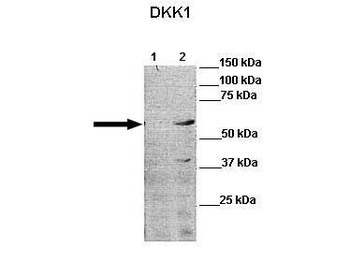 DKK1 Rabbit Polyclonal Antibody