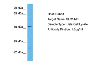 SLC14A1 Rabbit Polyclonal Antibody