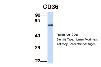 CD36 Rabbit Polyclonal Antibody