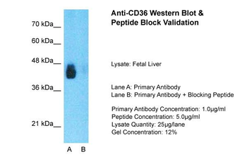 CD36 Rabbit Polyclonal Antibody