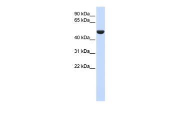 CD36 Rabbit Polyclonal Antibody