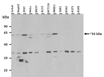 CD36 Rabbit Polyclonal Antibody