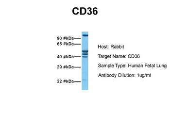 CD36 Rabbit Polyclonal Antibody