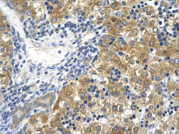 CD36 Rabbit Polyclonal Antibody