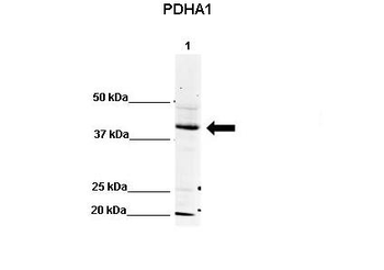 PDHA1 Rabbit Polyclonal Antibody