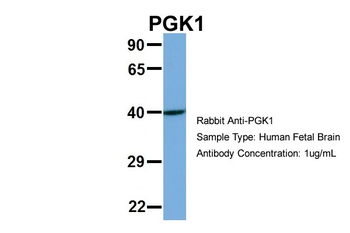 PGK1 Rabbit Polyclonal Antibody